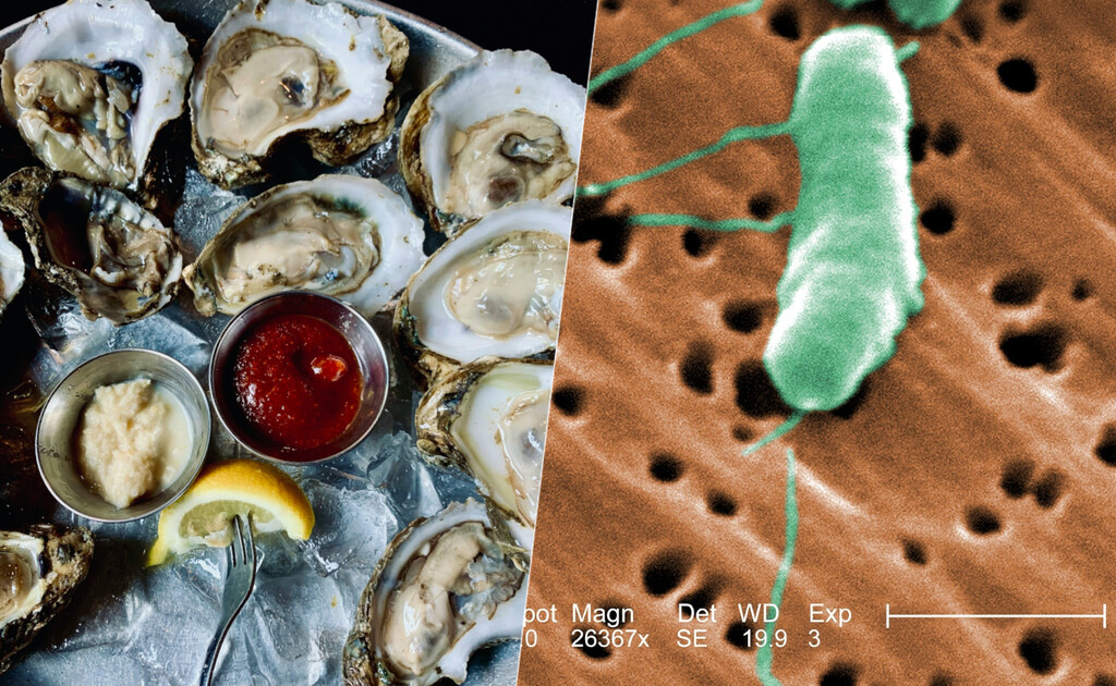 Qué es la «bacteria carnívora” y por qué Europa cree que ahora es el mejor momento para extremar precauciones
